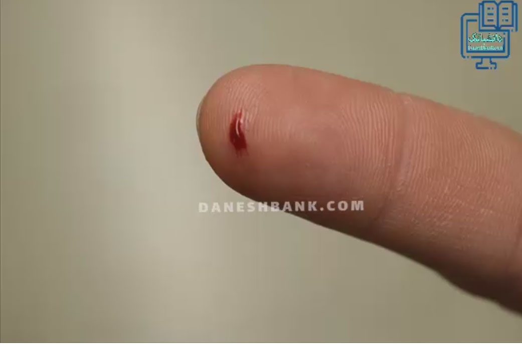 مشاهده  میکروسکوپی گلبول های خون